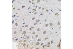Immunohistochemistry of paraffin-embedded rat brain using VEPH1 antibody. (VEPH1 Antikörper  (AA 448-547))