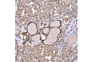 IHC analysis of NLRX1 using anti-NLRX1 antibody (ABIN7602716). (NLRX1 Antikörper  (AA 98-874))