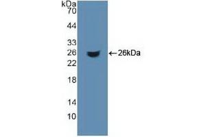 Detection of Recombinant ACO1, Human using Polyclonal Antibody to Aconitase 1 (ACO1) (Aconitase 1 Antikörper  (AA 26-243))