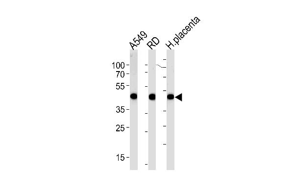 Actin Antikörper  (C-Term)