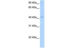 Image no. 1 for anti-Arylacetamide Deacetylase (Esterase) (AADAC) (AA 301-350) antibody (ABIN205073) (AADAC Antikörper  (AA 301-350))