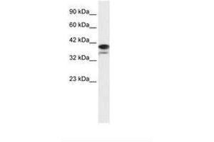 Image no. 1 for anti-Poly (ADP-Ribose) Polymerase Family, Member 6 (PARP6) (AA 72-121) antibody (ABIN202705) (PARP6 Antikörper  (AA 72-121))