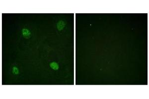 Immunofluorescence analysis of HeLa cells, using hnRPD (Phospho-Ser83) antibody. (HNRNPD/AUF1 Antikörper  (pSer83))