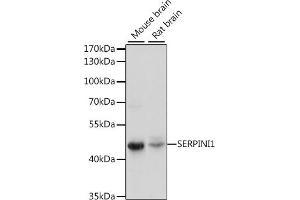 Western blot analysis of extracts of various cell lines, using SERPINI1 antibody (ABIN7270251) at 1:1000 dilution. (Neuroserpin Antikörper  (AA 181-410))
