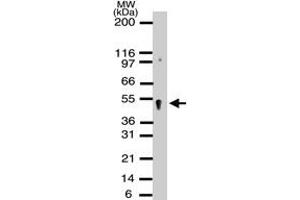 Western blot analysis of APEXL2 in HeLa cell lysates using APEX2 polyclonal antibody  at a dilution of 1 : 500. (APEX2 Antikörper)