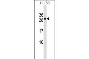 Western blot analysis in HL-60 cell line lysates (35ug/lane). (TMED6 Antikörper  (AA 125-153))