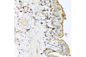 Immunohistochemistry of paraffin-embedded mouse lung using PRSS1 antibody at dilution of 1:100 (40x lens).