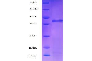 SDS-PAGE (SDS) image for RuvA (AA 1-203), (full length) protein (His-SUMO Tag) (ABIN5711038) (RuvA Protein (AA 1-203, full length) (His-SUMO Tag))
