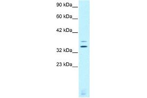 WB Suggested Anti-CHX10 Antibody Titration:  0.