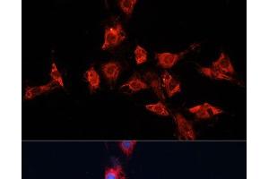 Immunofluorescence analysis of C6 cells using ADAM11 Polyclonal Antibody at dilution of 1:100. (ADAM11 Antikörper)