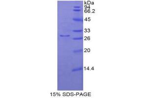 SDS-PAGE (SDS) image for Nitric Oxide Synthase 3 (Endothelial Cell) (NOS3) (AA 758-1004) protein (His tag) (ABIN1879462)