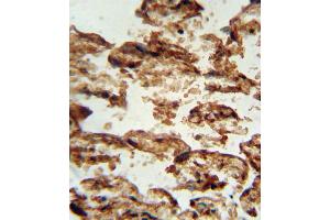 Immunohistochemistry (IHC) image for anti-Insulin-Like Growth Factor Binding Protein 4 (IGFBP4) antibody (ABIN3002898) (IGFBP4 Antikörper)
