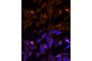Immunofluorescence analysis of NIH-3T3 cells using VPS36 Polyclonal Antibody (ABIN7271277) at dilution of 1:100 (40x lens). (VPS36 Antikörper  (AA 70-220))