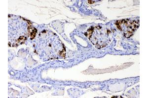 IHC analysis of RBP4 using anti-RBP4 antibody . (RBP4 Antikörper  (AA 19-201))