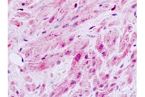 Human, Prostate, smooth muscle: Formalin-Fixed Paraffin-Embedded (FFPE)