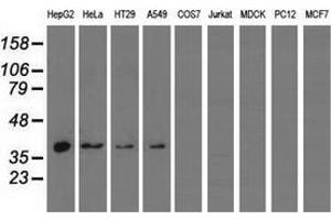 Western blot analysis of extracts (35 µg) from 9 different cell lines by using anti-HIBCH monoclonal antibody. (HIBCH Antikörper)