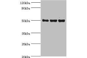 Western blot All lanes: TERF1 antibody at 2 μg/mL Lane 1: k562 whole cell lysate Lane 2: 293T whole cell lysate Lane 3: Jurkat whole cell lysate Secondary Goat polyclonal to rabbit IgG at 1/10000 dilution Predicted band size: 51, 49 kDa Observed band size: 51 kDa (TRF1 Antikörper  (AA 260-439))