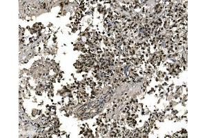 IHC analysis of FOXA2 using anti-FOXA2 antibody (ABIN7600003).