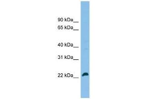 SPATA24 antibody used at 1 ug/ml to detect target protein. (SPATA24 Antikörper  (C-Term))