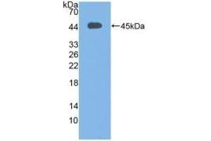 Detection of Recombinant C3c, Human using Polyclonal Antibody to Complement C3 Convertase (C3 Convertase) (Complement C3 Convertase Antikörper)