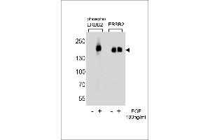 Western blot analysis of extracts from A431 cells,untreated or treated with EGF,100 ng/mL ,using phospho ERBB2-(left) or ERBB2 Antibody (right) (ErbB2/Her2 Antikörper  (pTyr1127))