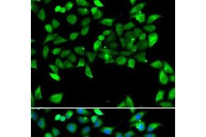 Immunofluorescence analysis of U2OS cells using EIF3H Polyclonal Antibody (EIF3H Antikörper)