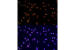 anti-Structural Maintenance of Chromosomes 3 (SMC3) antibody