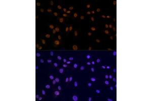 Immunofluorescence analysis of C6 using SMC3 antibody (ABIN7270616) at dilution of 1:100.