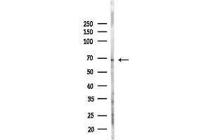 anti-Carnitine O-Acetyltransferase (CRAT) (N-Term) antibody