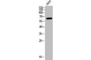 Western Blot analysis of 293T cells using Phospho-Akt1 (Y474) Polyclonal Antibody (AKT1 Antikörper  (pTyr474))