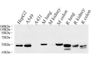Western Blot analysis of various samples using CK-7 Monoclonal Antibody at dilution of 1:1000. (Cytokeratin 7 Antikörper)