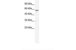 Image no. 2 for anti-General Transcription Factor IIE, Polypeptide 1, alpha 56kDa (GTF2E1) (C-Term) antibody (ABIN6736041) (GTF2E1 Antikörper  (C-Term))