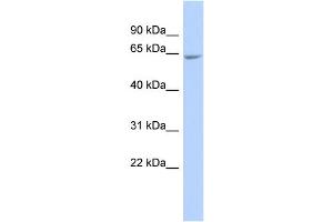 WB Suggested Anti-GALNTL4 Antibody Titration:  0. (UDP-N-Acetyl-alpha-D-Galactosamine:polypeptide N-Acetylgalactosaminyltransferase 18 (GALNT18) (Middle Region) Antikörper)