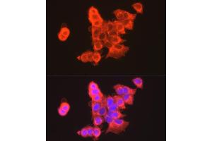 Immunofluorescence analysis of MCF7 cells using CLDN3 antibody (ABIN3017039, ABIN3017040, ABIN3017041, ABIN1679261 and ABIN6219930) at dilution of 1:100. (Claudin 3 Antikörper)