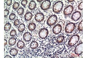 Immunohistochemistry (IHC) image for anti-2'-5'-Oligoadenylate Synthetase 2, 69/71kDa (OAS2) (Internal Region) antibody (ABIN6287767)