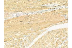 ABIN6260856 and ABIN6273101 at 1/100 staining human tongue carcinoma by IHC-P. (CKMT1A Antikörper  (N-Term))