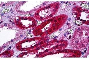 Human Kidney, Tubules: Formalin-Fixed, Paraffin-Embedded (FFPE) (AKR1B1 Antikörper  (AA 1-316))