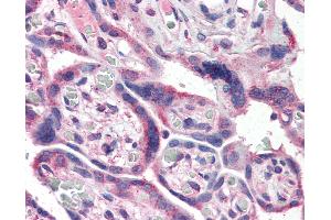 Immunohistochemistry (IHC) image for anti-Nuclear Factor of kappa Light Polypeptide Gene Enhancer in B-Cells 1 (NFKB1) (AA 1-15) antibody (ABIN337304)