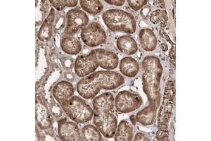 Immunohistochemical staining of human kidney with ETAA1 polyclonal antibody  shows distinct nuclear and cytoplasmic positivity in tubular cells. (ETAA1 Antikörper)