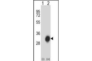 Western blot analysis of HLA-DPB1 (arrow) using rabbit polyclonal HLA-DPB1 Antibody (Center) (ABIN657755 and ABIN2846737). (HLA-DPB1 Antikörper  (AA 77-105))