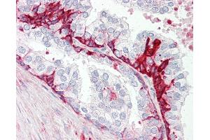 Anti-GPR55 antibody IHC staining of human prostate. (GPR55 Antikörper  (C-Term))