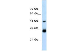 WB Suggested Anti-HOXC9 Antibody Titration:  2. (HOXC9 Antikörper  (Middle Region))