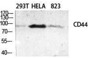 Western Blot (WB) analysis of specific cells using CD44 Polyclonal Antibody. (CD44 Antikörper  (Ser2152))