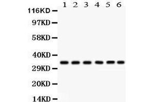 Western Blotting (WB) image for anti-Cyclin-Dependent Kinase 1 (CDK1) (AA 66-297) antibody (ABIN3043473) (CDK1 Antikörper  (AA 66-297))