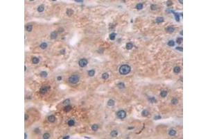 IHC-P analysis of Human Tissue, with DAB staining. (Complement Factor I Antikörper  (AA 340-583))