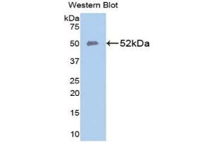 Detection of Recombinant FPN, Human using Polyclonal Antibody to Ferroportin (FPN) (SLC40A1 Antikörper  (AA 127-321))