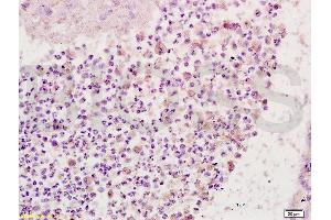 Immunohistochemistry (IHC) image for anti-Fc Fragment of IgG, High Affinity Ia, Receptor (CD64) (FCGR1A) (AA 101-200) antibody (ABIN747413)