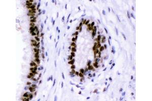 IHC analysis of p95 NBS1 using anti-p95 NBS1 antibody (ABIN3043282). (Nibrin Antikörper  (C-Term))