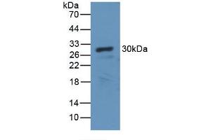 Detection of Recombinant CA2, Canine using Polyclonal Antibody to Carbonic Anhydrase II (CA2)