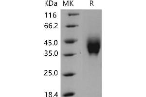 IFNGR2 Protein (His tag)